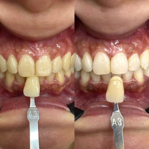 IMG_1028